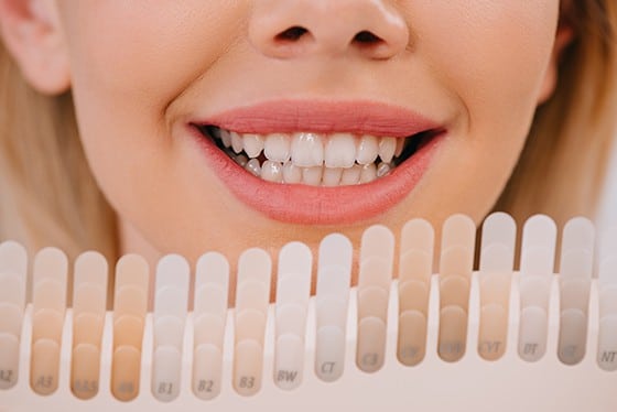 cropped view of smiling woman holding teeth color palette, teeth