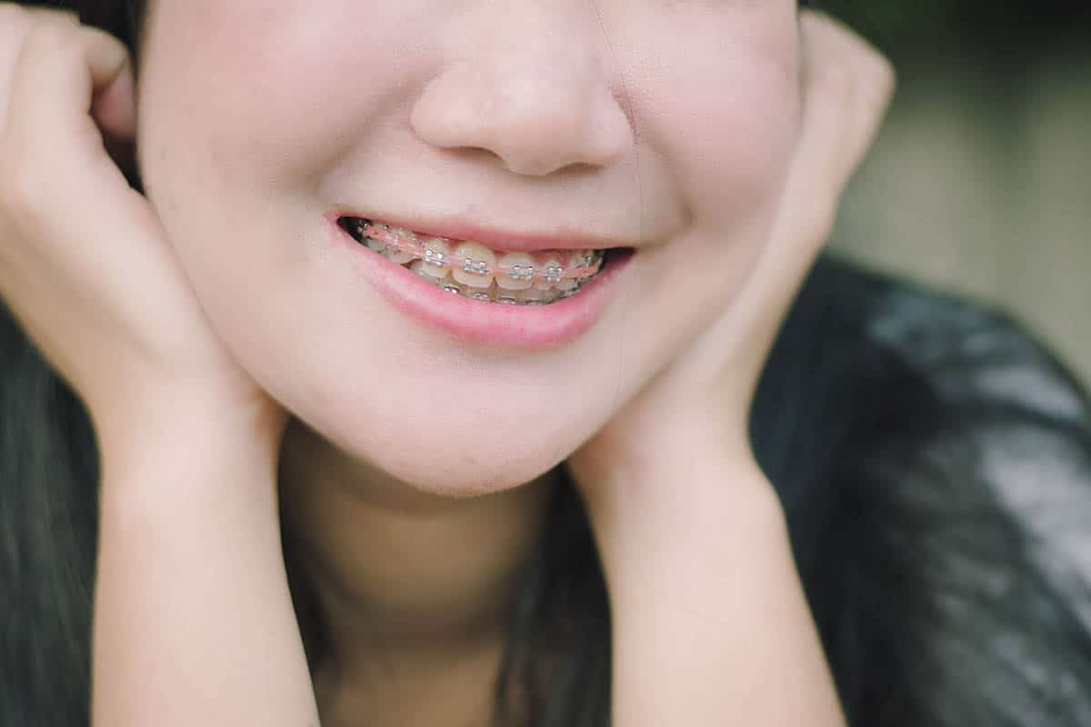 singapore student with braces smiling