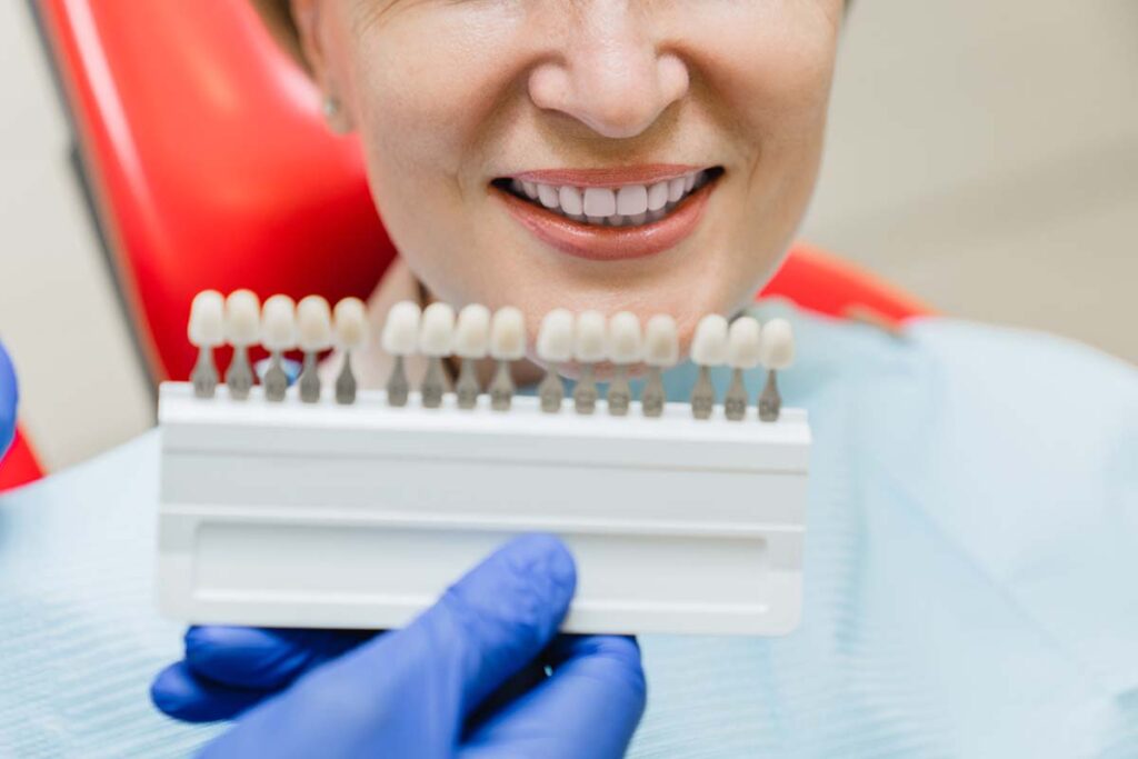 Veneers Singapore Cost, Composite, Porcelain Pristine Dentalworks