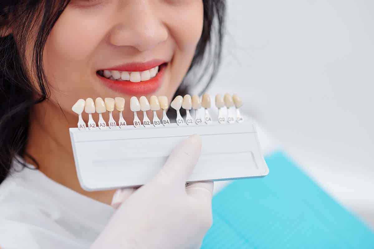 dentist using colour palette to determine teeth whitening grade on patient