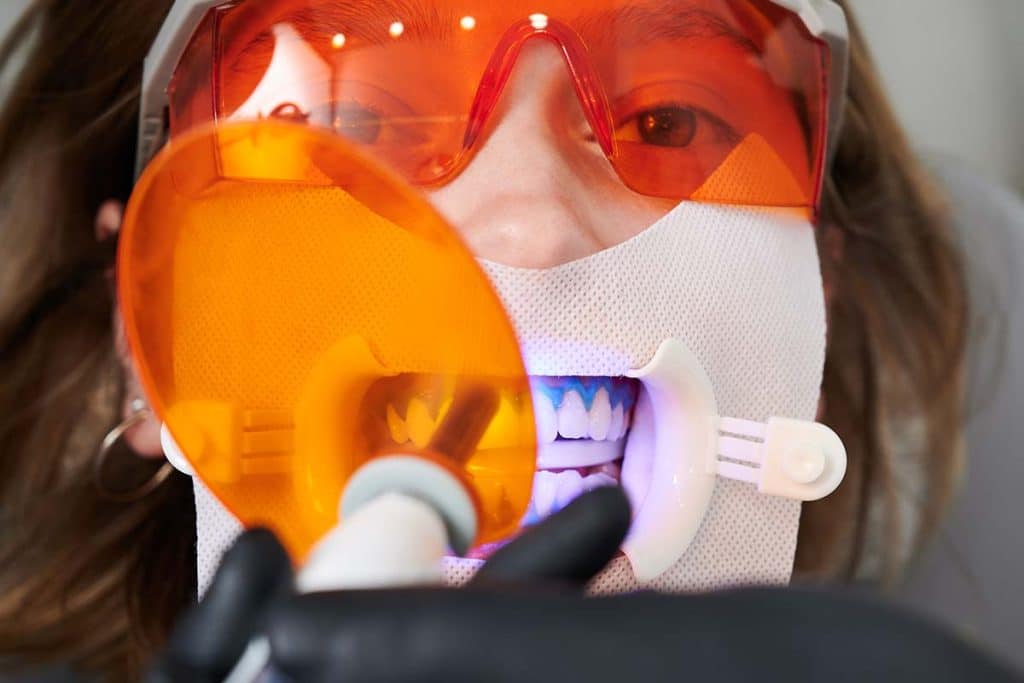 dentist performing led teeth whitening from the point of view of the dentist