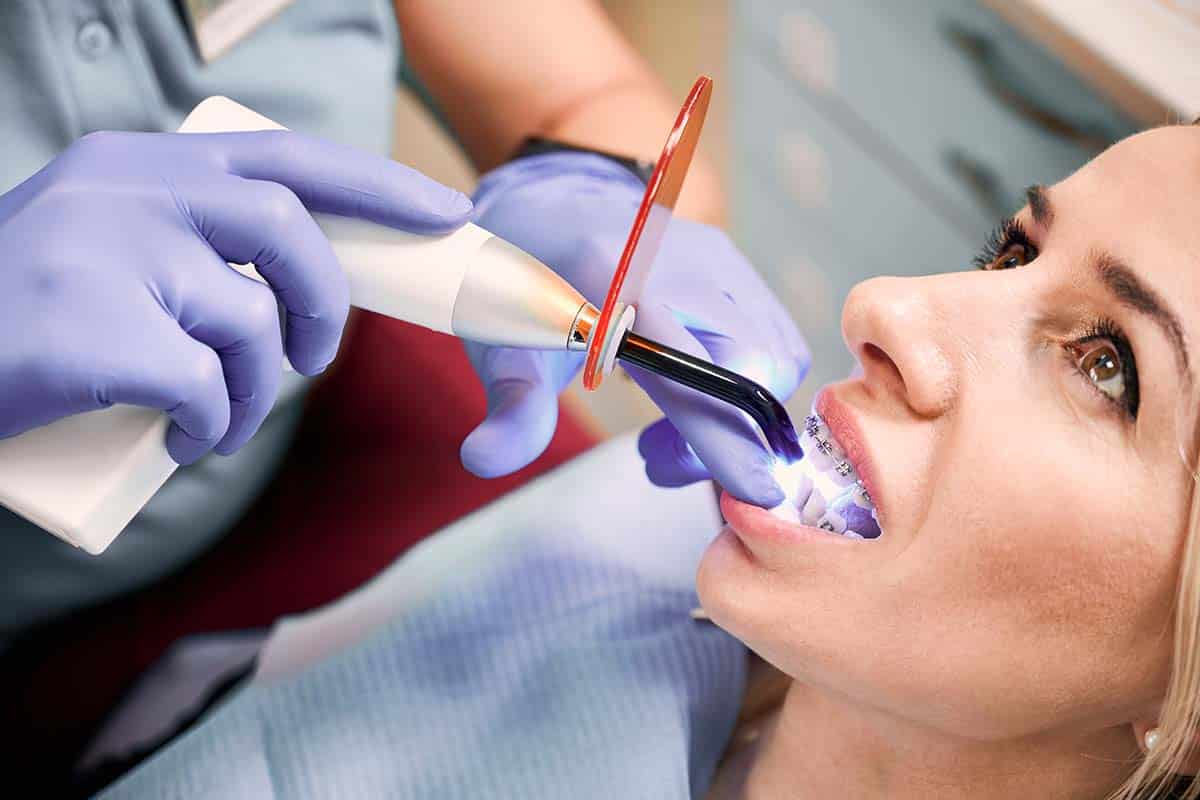 Laser Teeth Whitening Singapore How Does It Work? Pristine Dentalworks