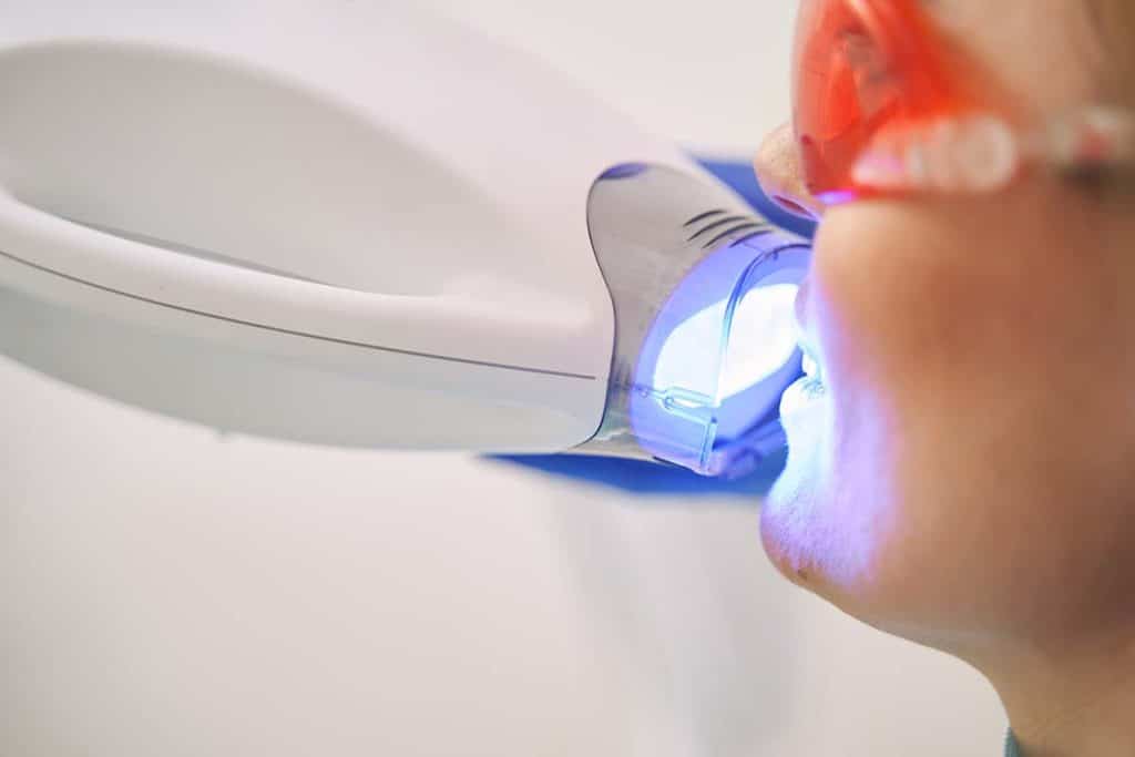 woman having laser teeth whitening treatment in singapore