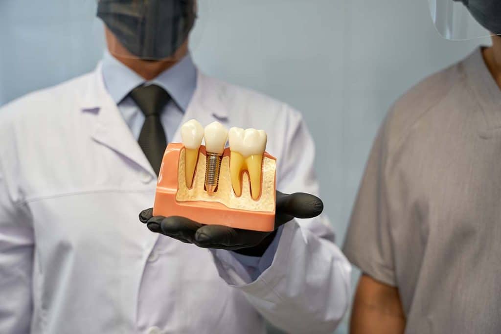 dental technician presenting a model of dental implants to patient